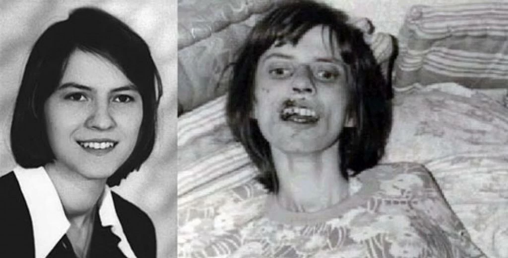 Anneliese Michel előtte utána ördögűzés exorcizmus 1976 német lány tragikus halál vallási fanatizmus démon megszállás rejtély bűnügy