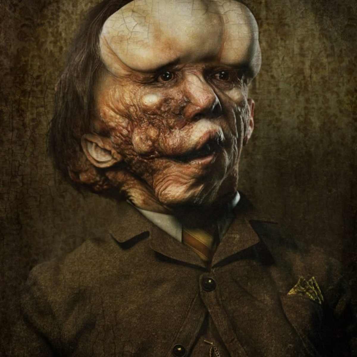 Joseph Merrick: Az Elefántember